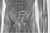 XrayScannersPrisons